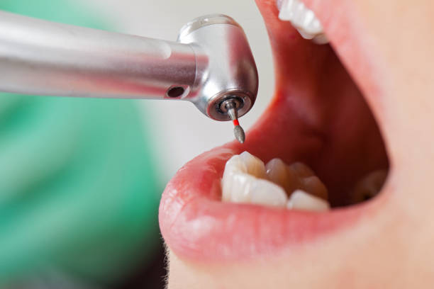 Best Emergency Dental Care for Broken or Chipped Teeth in Wescosville, PA